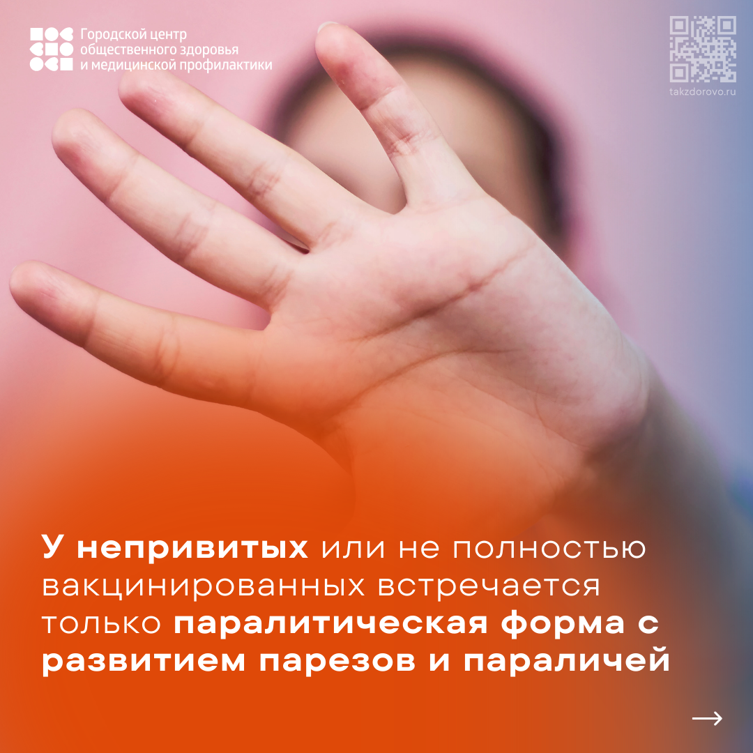 Полиомиелит